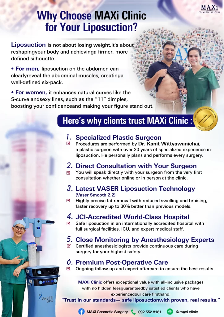 Smooth, firm skin after VASER Smooth 2.2 liposuction with minimal bruising — Before and After, Thailand