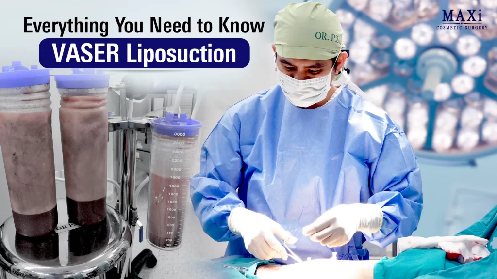 Dr. Kanit performing VASER liposuction surgery in a modern operating room, with fat collected in canisters shown beside the surgical table — VASER Liposuction in Thailand